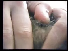 Explication de poilu